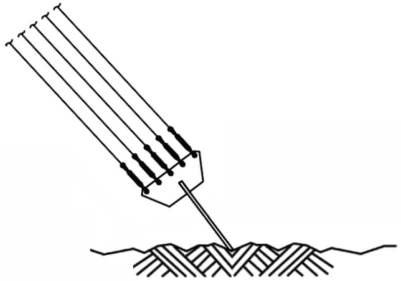 Diagram of a tower guy anchoring system